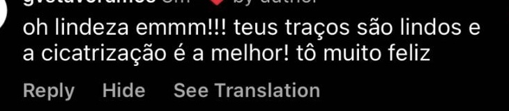 Depoimento curto sobre resultado de tatuagem de linha fina